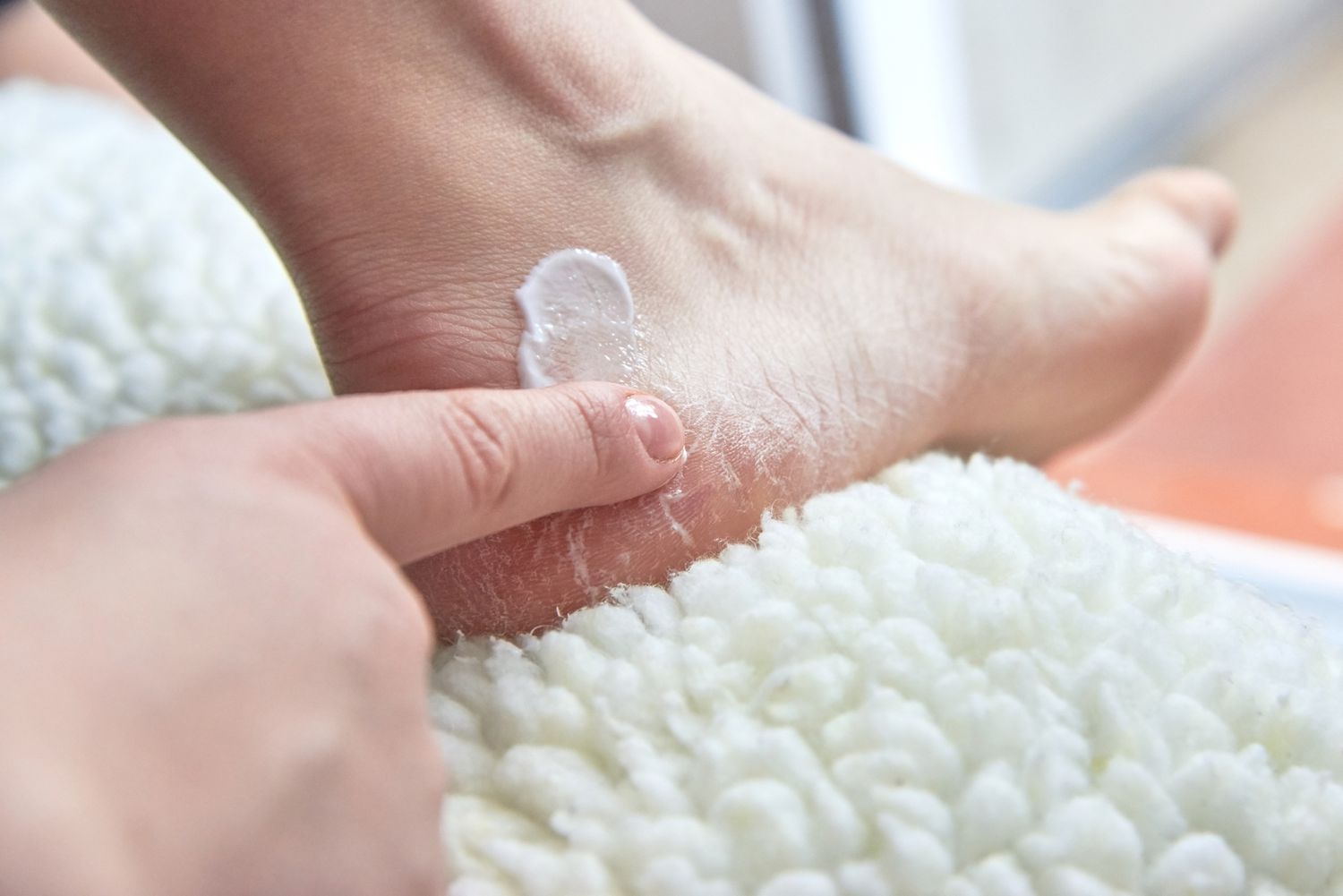 Anti Fungal Combination