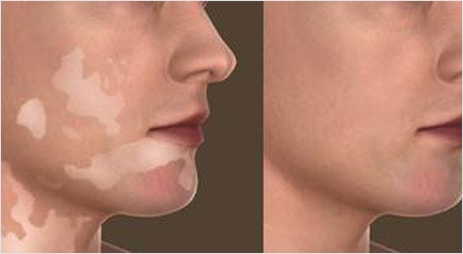 Dermato Cosmetic